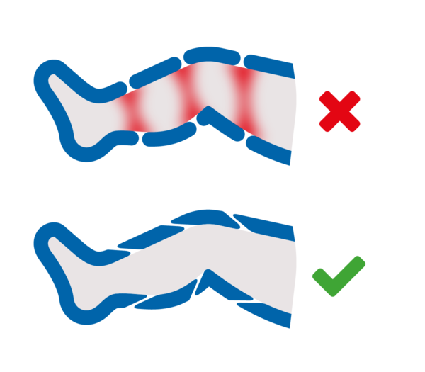 VE overlapping vergleich auslaufmodell venenengel 1200x1050 be9aee27 30af 4f28 8772 4c6e74835482 600x